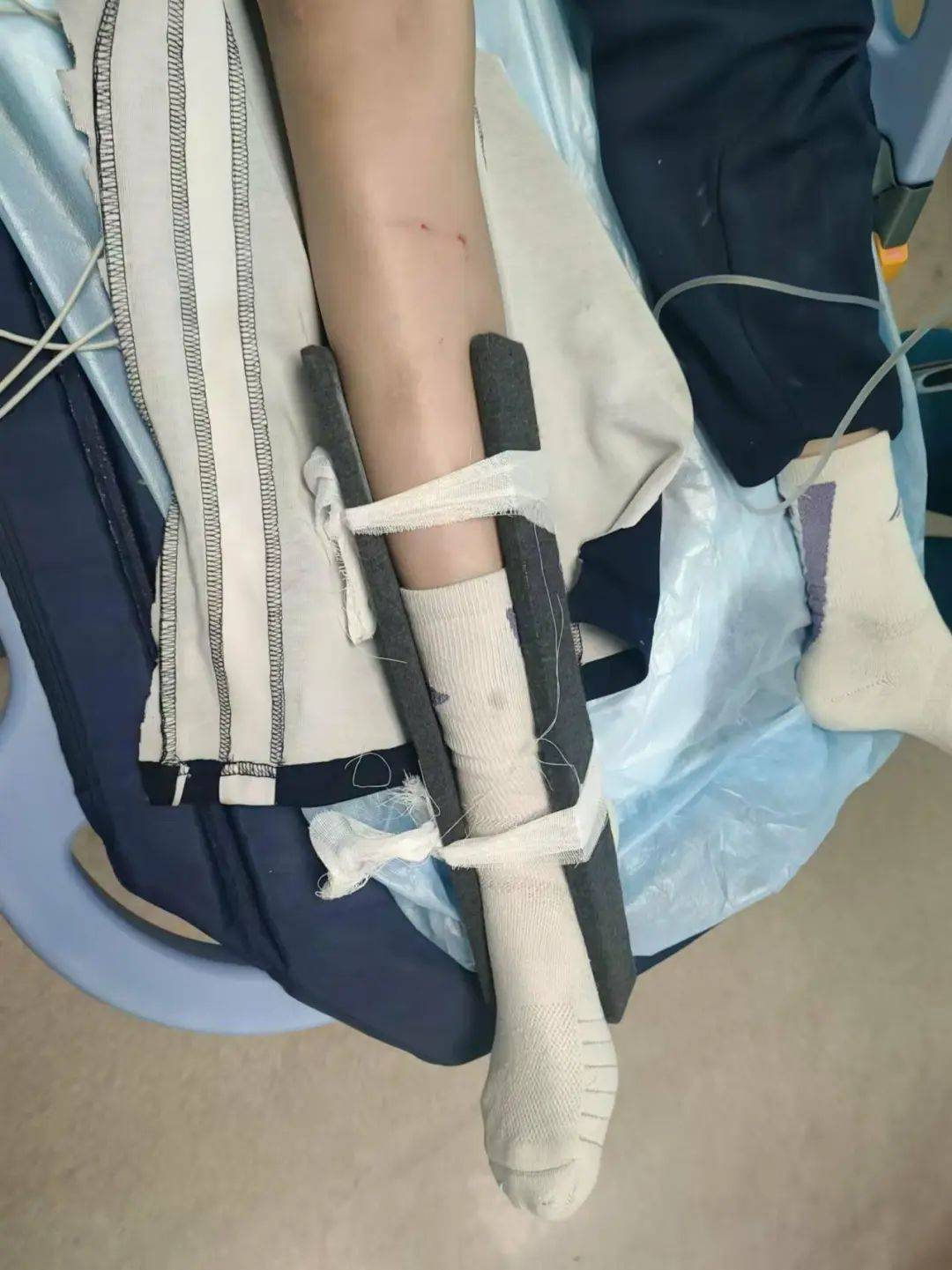 惨痛<strong></p>
<p>teecoin货币交易中心</strong>！一人身亡！深圳多名学生骑电动车发生意外