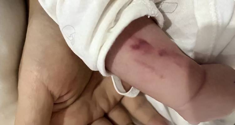 广西一男婴在月子中心被照料20天：身上2处骨折<strong></p>
<p>共生币交易今日价格</strong>，育婴室监控无法查看