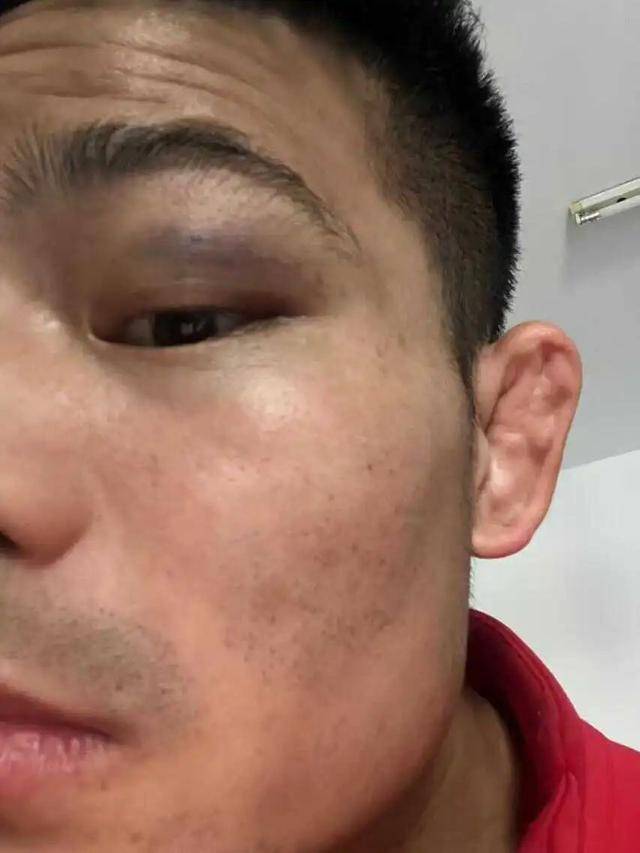 全国武术散打季军称遭多名运动员群殴霸凌<strong></p>
<p>现在炒币炒哪个品种好</strong>，患上重度抑郁
