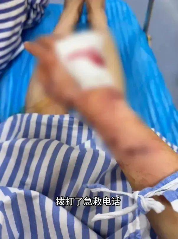 洗澡时突然爆炸<strong></p>
<p>如何做空货币</strong>，女子手筋断裂，多处缝针……家里有它快自查