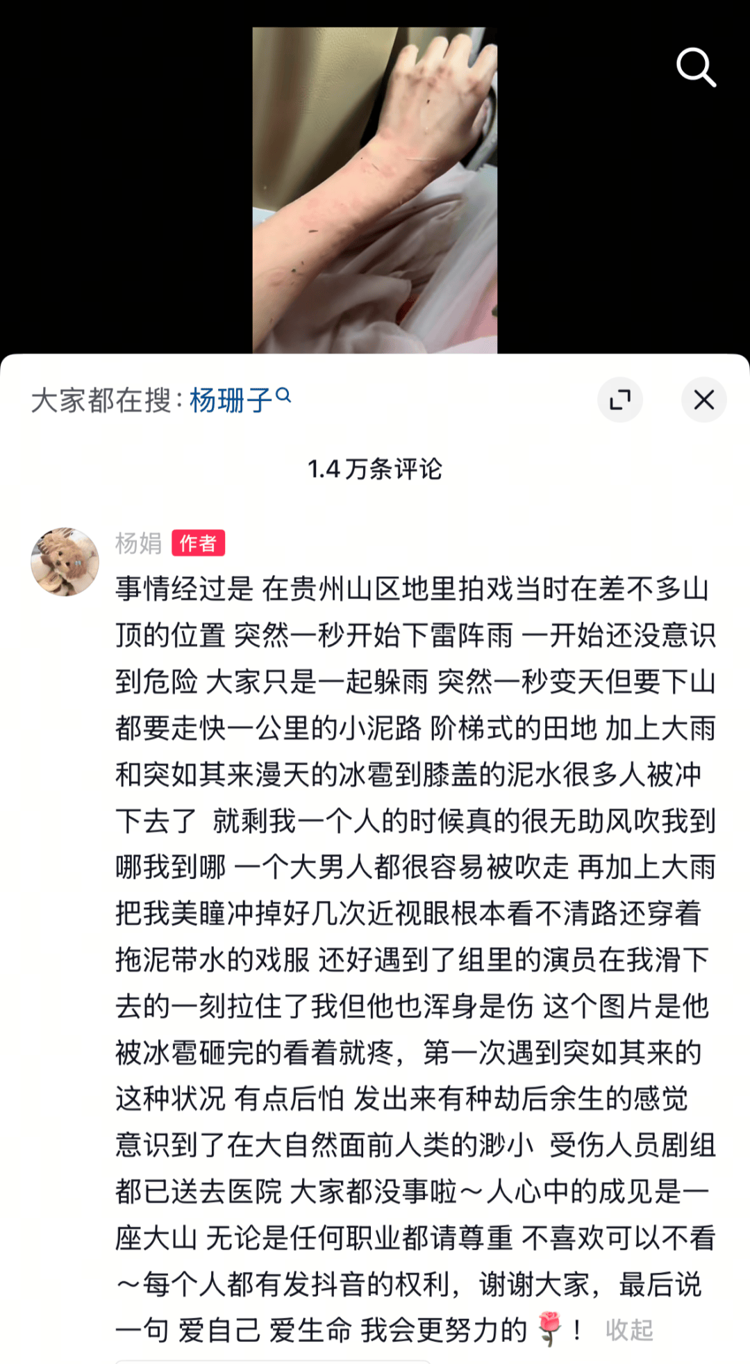女演员杨珊子拍戏遇极端天气！胳膊被冰雹砸伤、美瞳被冲掉<strong></p>
<p>易捷币怎么用</strong>，剧组受伤人员已送医